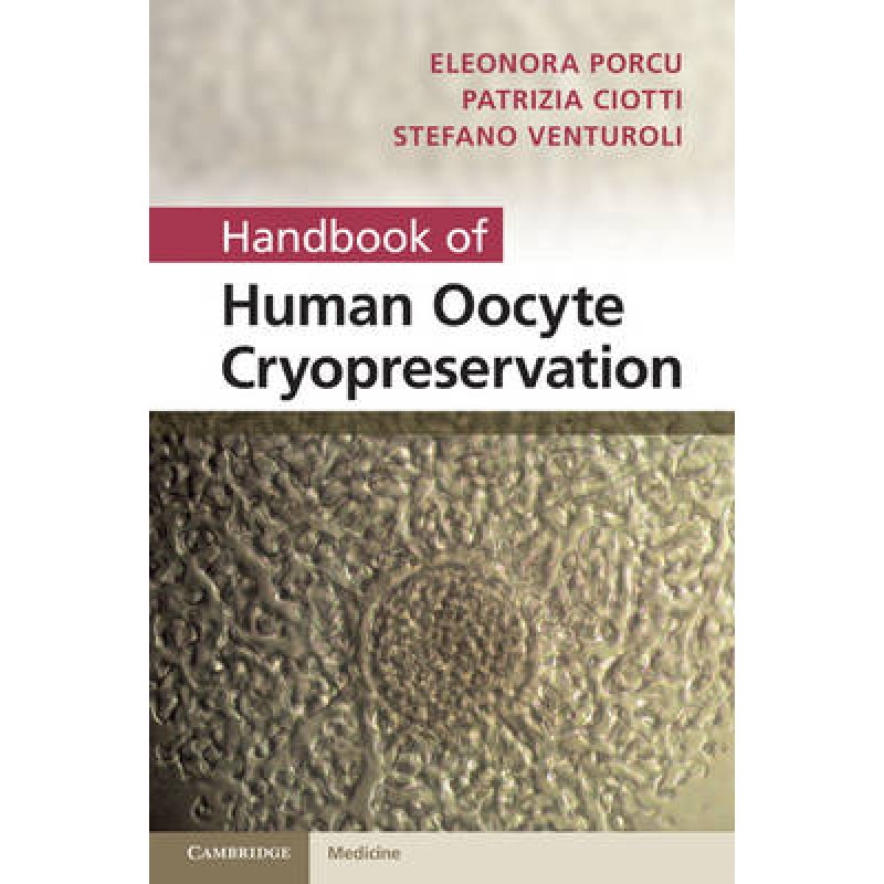 Handbook of Human Oocyte Cryopreservation